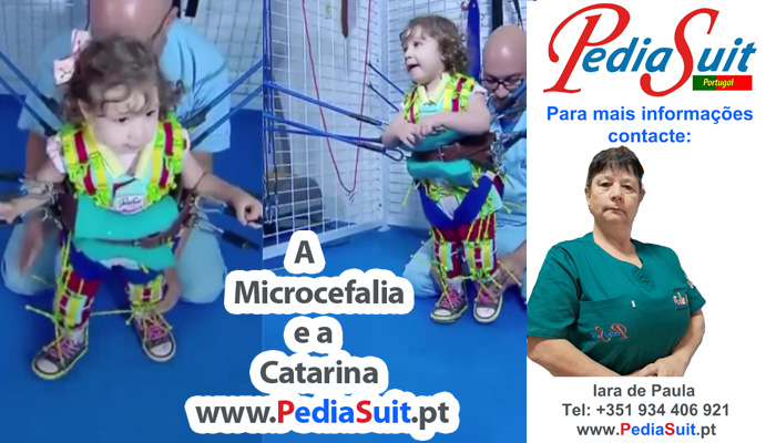 Microcefalia - A história da Catarina com o PediaSuit